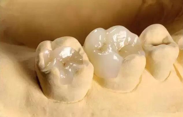最新口臭牙的成因、治療與預防措施，全面解析口臭問題，守護口腔健康